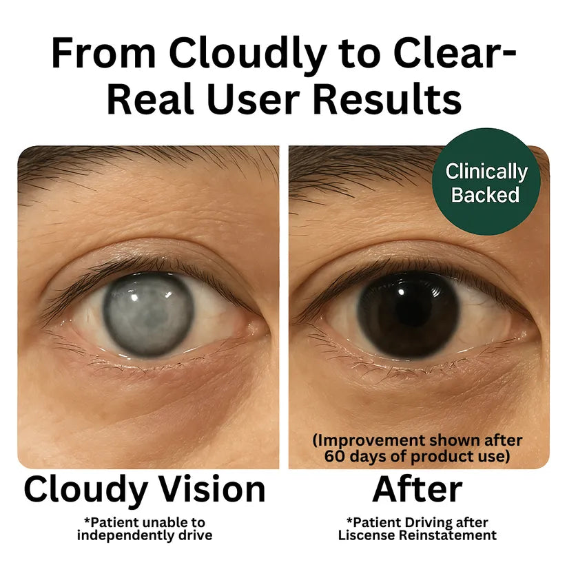 Zona Lutenvision-suplemento vitamínico y mineral para la salud ocular (90 cápsulas)